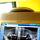 발치과拔齒科 유감 Extract Healthy Tooth? 이미지