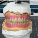 선치과기공소 이미지