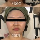 문스킨&바디 이미지