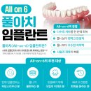안면기공소 네이버블로그
