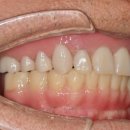 리온치과기공소 이미지