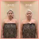 [뷰티일기]창원피부관리 혜리온에스테틱 맘스산후관리로 전신 순환 힐링하고 온 후기