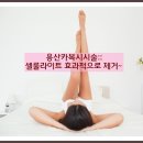 용산카복시시술::셀룰라이트 효과적으로 제거~ 이미지