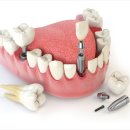 서울S플러스치과의원 이미지