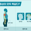 시신경척수염 시신경 척수염 원인 증상 데빅 증후군 시신경척수염 합병증 다발성경화증 비교 이미지