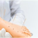 맞춤한의원 이미지