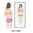 섭식 장애[Eating disorder]뇌신경정신질환 이미지