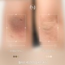 원케어존