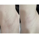 스위스 익스필 | 스위스익스필 혜화점 | 종로 왁싱 겨드랑이제모 솔직후기
