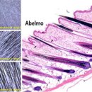 식물성추출물(아벨모) ‘아사쿠린’, 과학적 방법의 탈모치료제? 이미지