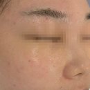 비타케어 | 진주피부관리샵 | 채지움뷰티 닥토필+비타케어 후기