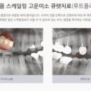 연세정직한치과의원 네이버블로그