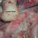 Feline infectious peritonitis (FIP) 이미지