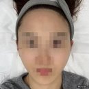 동탄피부관리 제이비비 동탄점에서 신부관리 물광관리 받은 후기