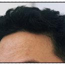 모디헤어플란트의원 이미지