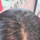 티로헤어
