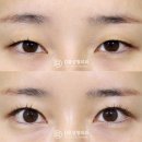 디비성형외과의원 이미지