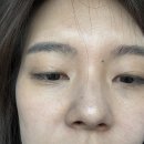 [용인/처인구] 봄철이라 방심말자,촉촉한 수분관리 &#39;벨르유에스테틱&#39;