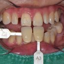 선치과기공소 이미지