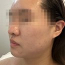 여우스킨앤바디 네이버블로그