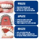 히트 치과기공소 네이버블로그