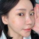 더웨이성형외과의원 | 강남역피부과 슈링크 리프팅 효과 통증 이중턱 전후 후기