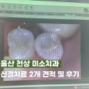 울산중앙의원 | 울산 천상 미소치과 신경치료 2개 견적 및 후기