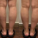 웰빙메디컬빌딩 | 팔뚝살, 이젠 안녕? 갸름한 라인 되찾는 비법!