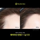 헤어라이 이미지