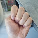 MSM 효능, 관절 건강에 도움을 주는 MSM 추천후기
