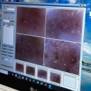 덕영빌딩 | 대구 블랙헤드 관리 추천 [B10에스테틱] 모공청소 후기