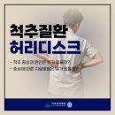 김포허리디스크, 방치하지 말고 초기 대응이 중요합니다 이미지