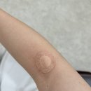 보건소 | 보건소 피검사 후기, 금식 꼭 해야하나요?