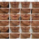 고려정성의원 | 써마지병원추천? 더 이상 후기에 의존하지 마세요.