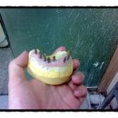 M치과기공소 이미지