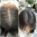 7532 | 천안 불당동 SMP 두피가르마 솔직후기 “아일린” 머리가 풍성해보이는 비결