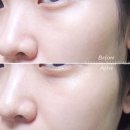 [토소웅] 안티링클 비티엑스 ♡ 탄력크림, 주름개선크림, 리프팅크림 추천 ♩