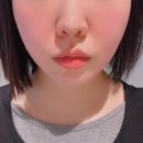 잇츠미의원 | 청담잇츠미의원 | 올라웨이브 + 볼뉴머 후기