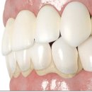 맑은플란트치과의원 이미지