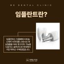 비에스브릿지 이미지