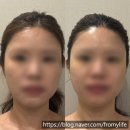 달구벌대로174길 | [대구 워터테라피/대실역피부관리] 워터테라피 대구 워터에어윤곽관리 다사 피부관리, 끌림인뷰티