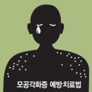 모공각화증 이미지