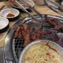 바른플란트치과교정과치과의원 | 태평역치과 딸 교정 드디어 끝났네요 (내돈내산)