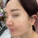 수원시 팔달구 팔달로 | 수원 헤드스파 피부관리샵 에스떼이브 뷰티케어 수원점 esV10모공디톡스 피지케어 후기