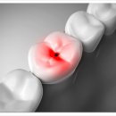 세라믹치과기공소 이미지