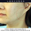 노블성형외과의원 이미지
