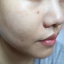 효성메디케어 | 여름철 수분관리 효성메디케어 수딩크림