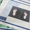 강남-190 | 강남성장클리닉 톨앤핏 대치점 오다리 교정운동 후기