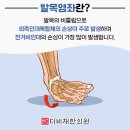 더비채