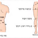 벌침 그림 처방 - 허리 디스크 이미지